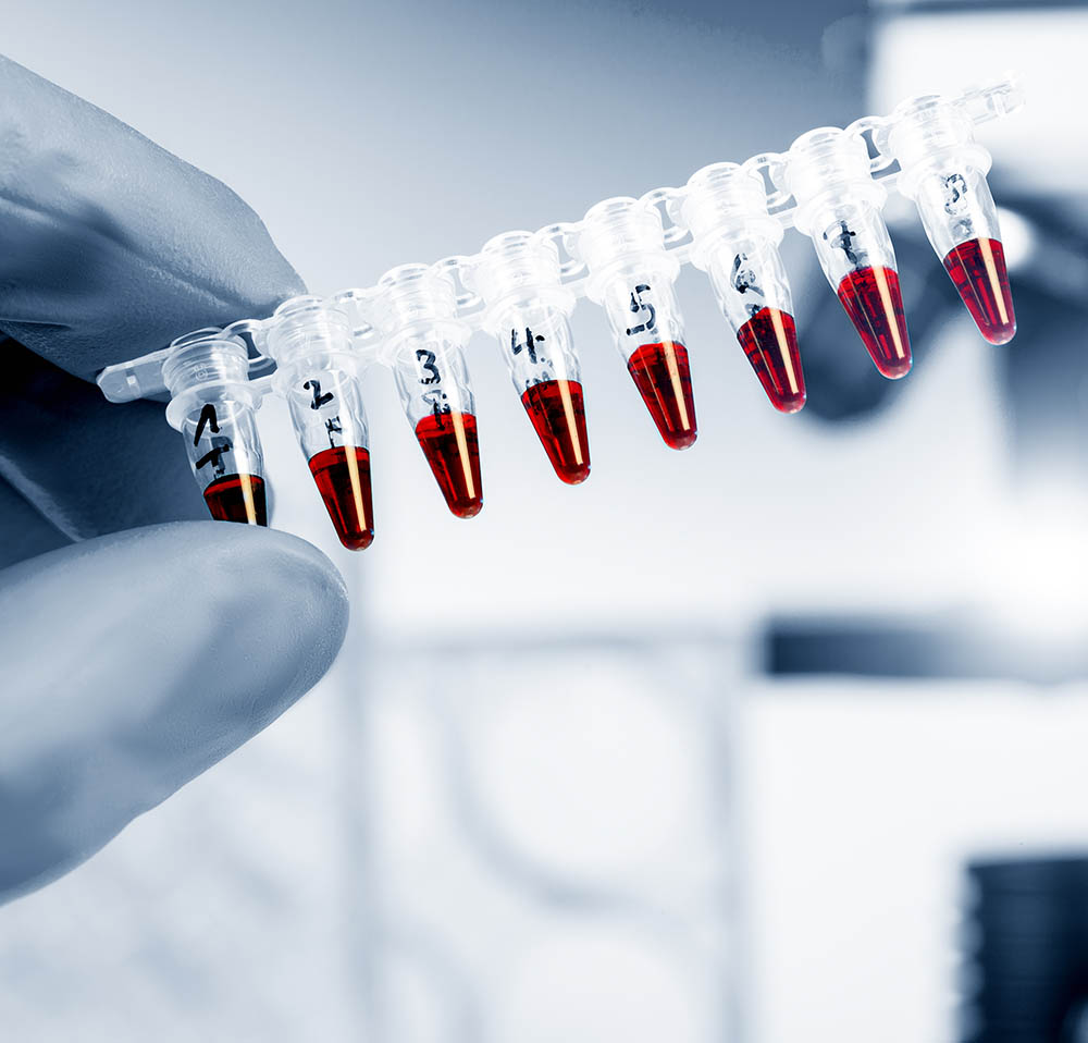 Análisis Bacteriológico (PCR)